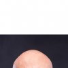 bald2.jpg